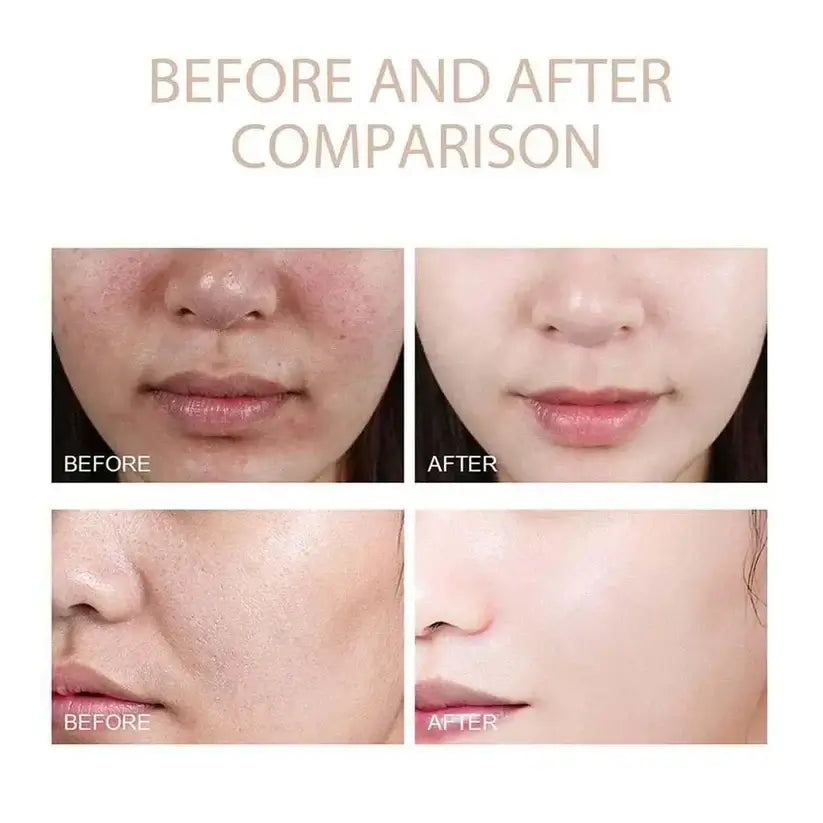 Meloxin Ampolla 30ml X 2 Unidades + Envío Grátis