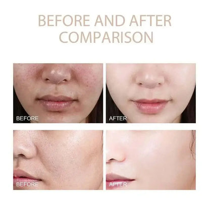 Meloxin Ampolla 30ml X 2 Unidades + Envío Grátis